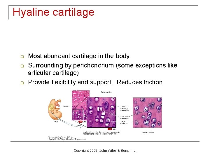 Hyaline cartilage q q q Most abundant cartilage in the body Surrounding by perichondrium