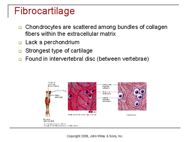 Fibrocartilage q q Chondrocytes are scattered among bundles of collagen fibers within the extracellular