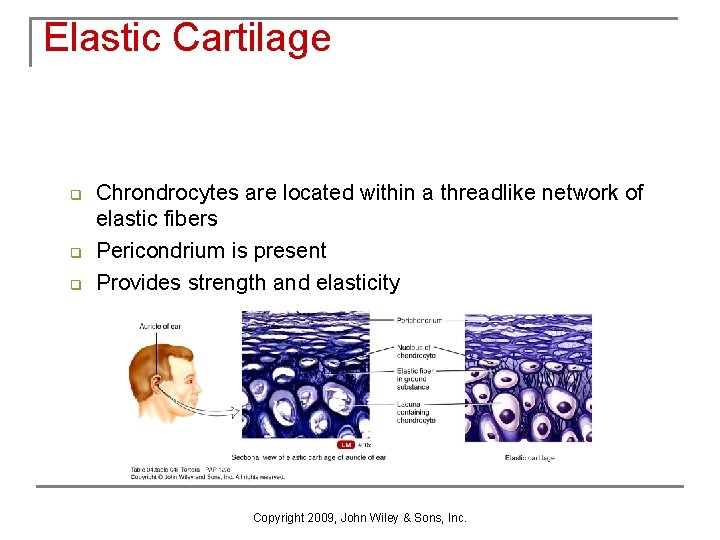 Elastic Cartilage q q q Chrondrocytes are located within a threadlike network of elastic