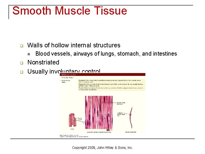 Smooth Muscle Tissue q Walls of hollow internal structures n q q Blood vessels,