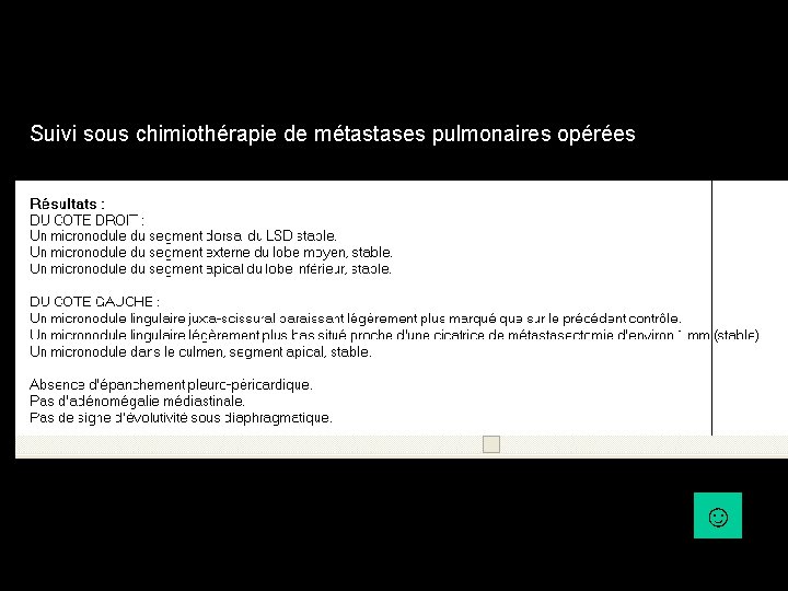 Suivi sous chimiothérapie de métastases pulmonaires opérées ☺ Suivi sous chimiothérapie de métastases pulmonaires opérées ☺