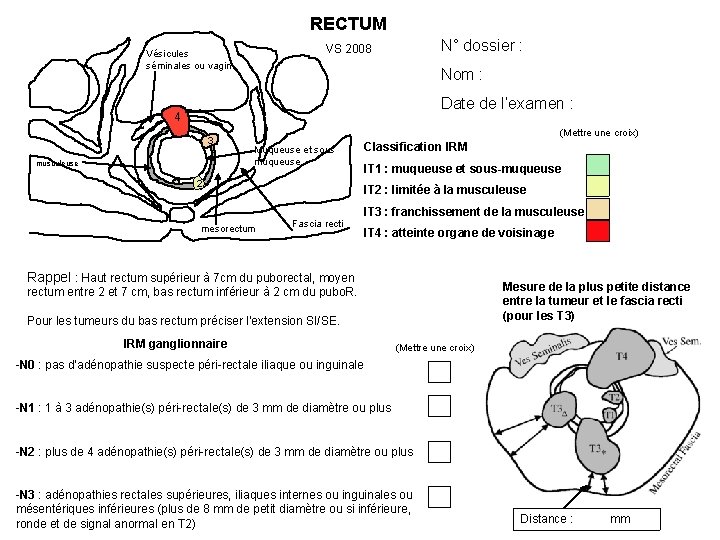 RECTUM N° dossier : VS 2008 Vésicules séminales ou vagin Nom : Date de RECTUM N° dossier : VS 2008 Vésicules séminales ou vagin Nom : Date de