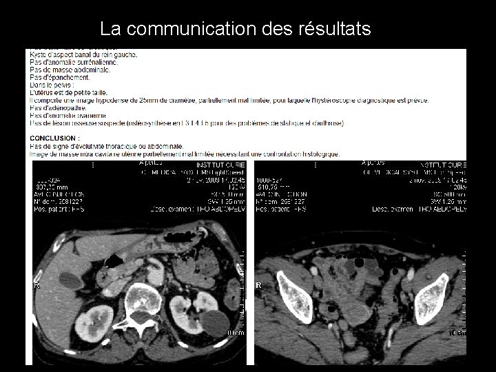 La communication des résultats La communication des résultats
