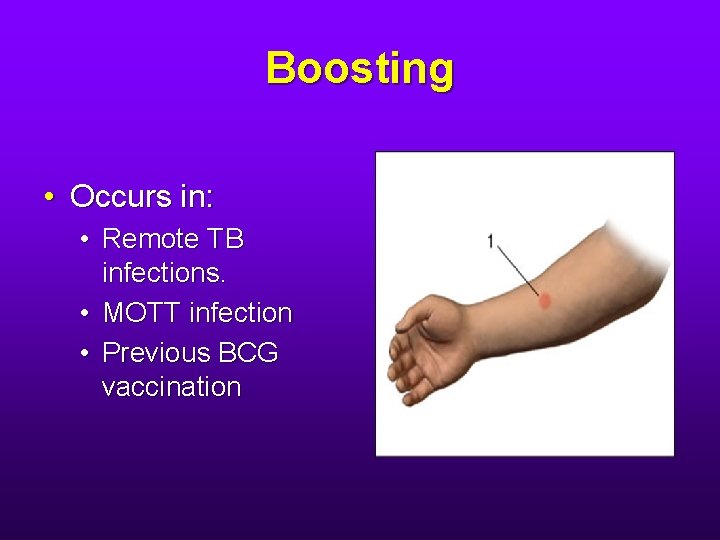 Boosting • Occurs in: • Remote TB infections. • MOTT infection • Previous BCG