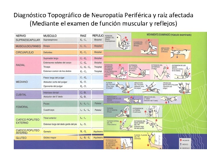 Diagnóstico Topográfico de Neuropatía Periférica y raíz afectada (Mediante el examen de función muscular
