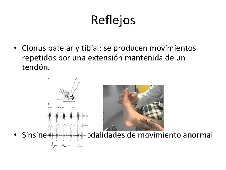 Reflejos • Clonus patelar y tibial: se producen movimientos repetidos por una extensión mantenida