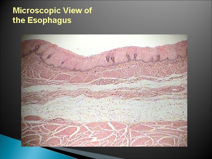 Microscopic View of the Esophagus 