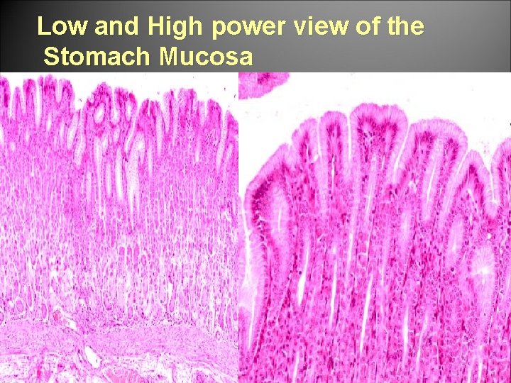 Low and High power view of the Stomach Mucosa 