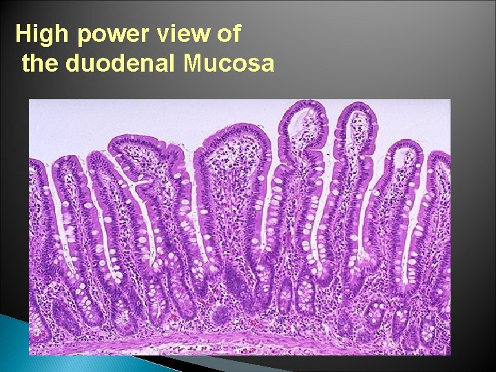 High power view of the duodenal Mucosa 