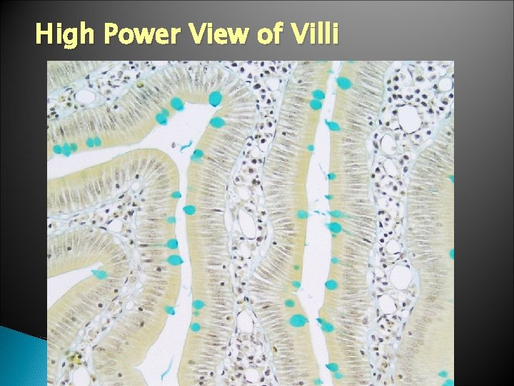 High Power View of Villi 