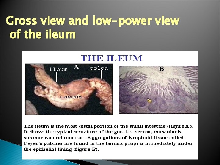 Gross view and low-power view of the ileum 