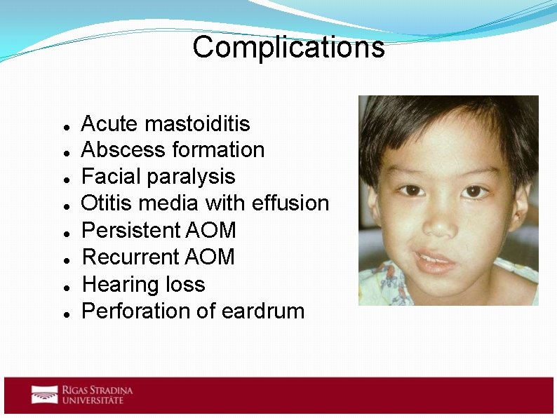 Complications Acute mastoiditis Abscess formation Facial paralysis Otitis media with effusion Persistent AOM Recurrent Complications Acute mastoiditis Abscess formation Facial paralysis Otitis media with effusion Persistent AOM Recurrent