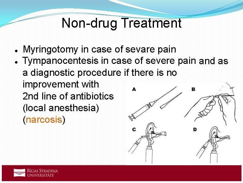 Non-drug Treatment Myringotomy in case of sevare pain Tympanocentesis in case of severe pain
