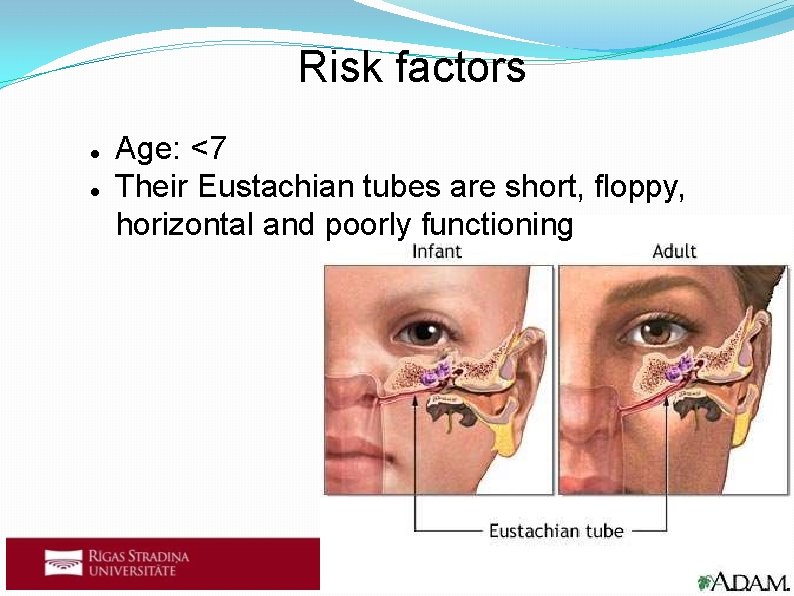 Risk factors Age: <7 Their Eustachian tubes are short, floppy, horizontal and poorly functioning