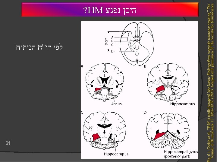  לפי דו"ח הניתוח 21 ig. 6. 1, Corkin et al. , “H. M.