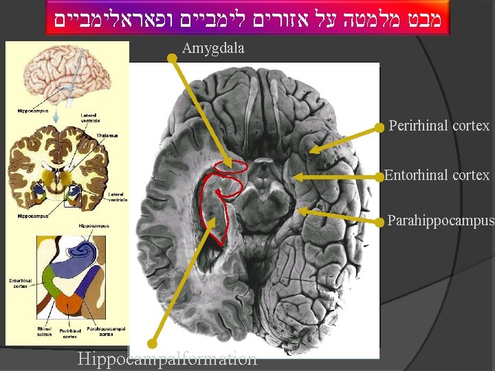  מבט מלמטה על אזורים לימביים ופאראלימביים Amygdala Perirhinal cortex Entorhinal cortex Parahippocampus 5