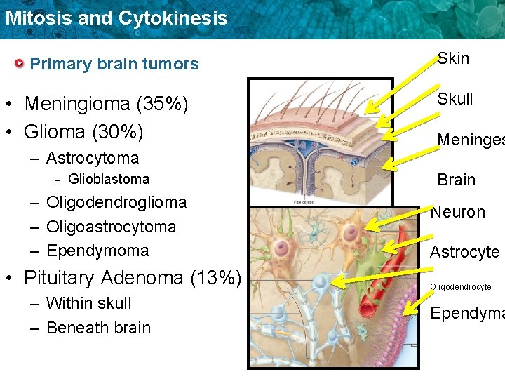 Mitosis and Cytokinesis Primary brain tumors • Meningioma (35%) • Glioma (30%) – Astrocytoma