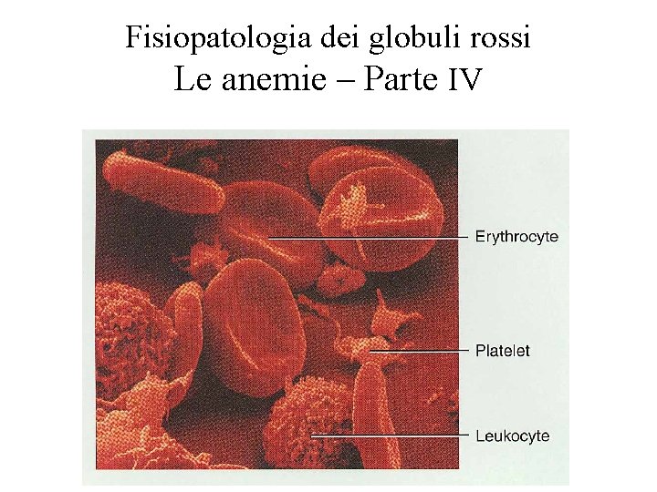 Fisiopatologia dei globuli rossi Le anemie – Parte IV 