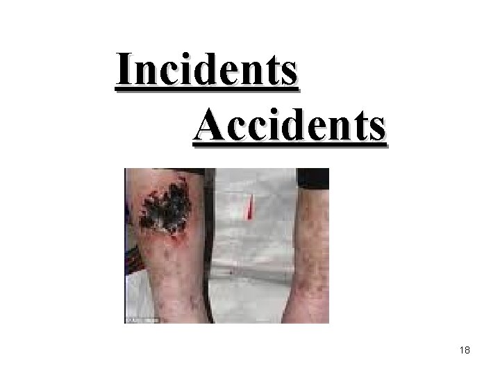 Incidents Accidents 18 