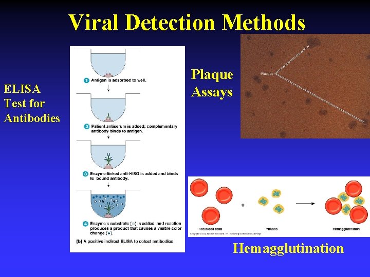Viral Detection Methods ELISA Test for Antibodies Plaque Assays Hemagglutination 