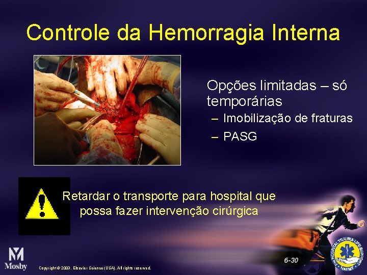 Controle da Hemorragia Interna Opções limitadas – só temporárias – Imobilização de fraturas –