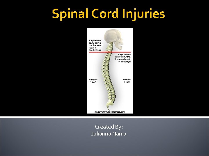 Spinal Cord Injuries Created By: Julianna Nania 