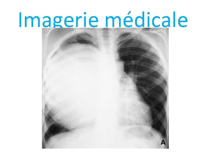 Imagerie médicale 