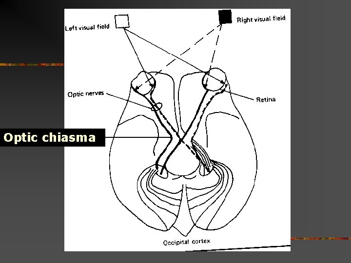 Optic chiasma Optic chiasma