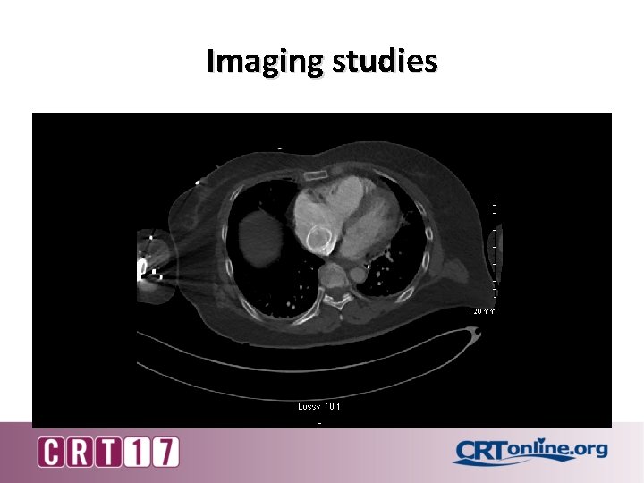Imaging studies 