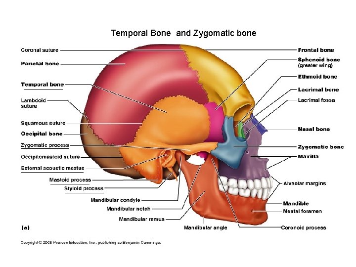 Temporal Bone and Zygomatic bone 