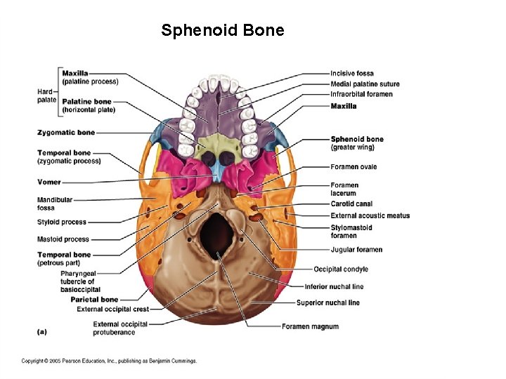 Sphenoid Bone 