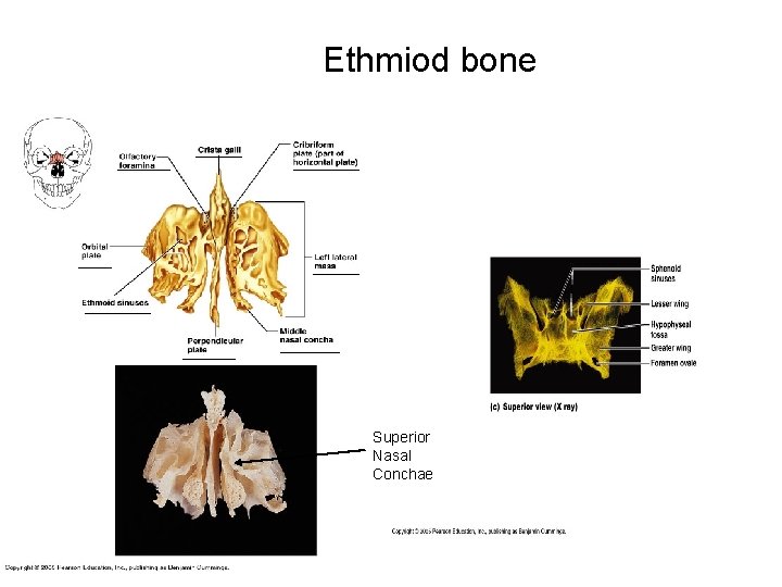 Ethmiod bone Superior Nasal Conchae 