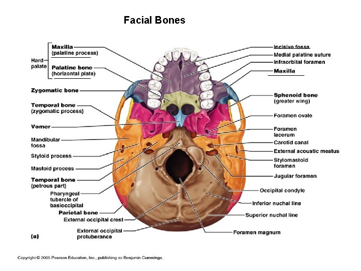 Facial Bones 