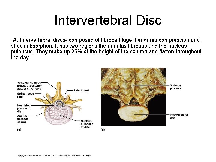 Intervertebral Disc • A. Intervertebral discs- composed of fibrocartilage it endures compression and shock