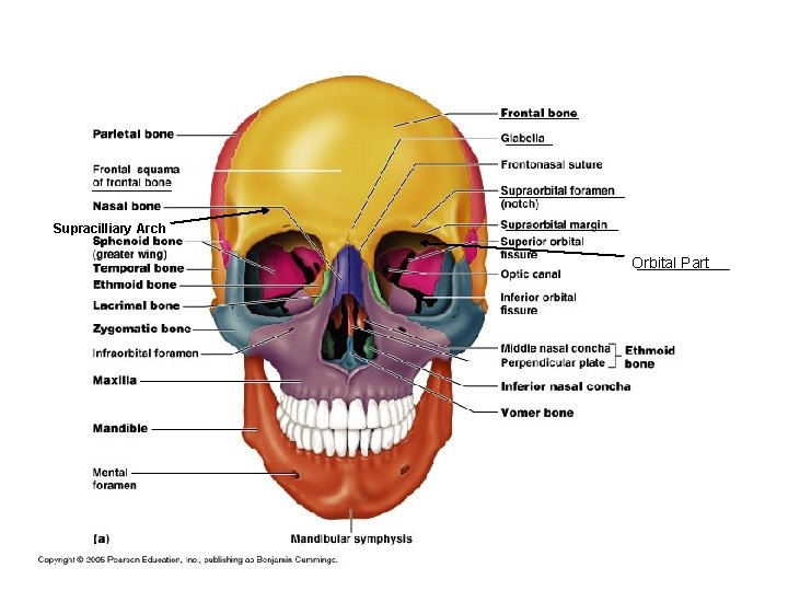 Supracilliary Arch Orbital Part 