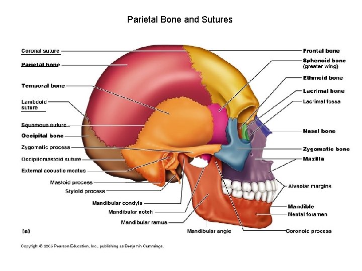 Parietal Bone and Sutures 