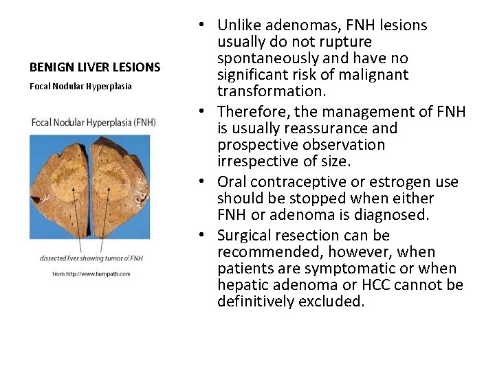 BENIGN LIVER LESIONS Focal Nodular Hyperplasia • Unlike adenomas, FNH lesions usually do not