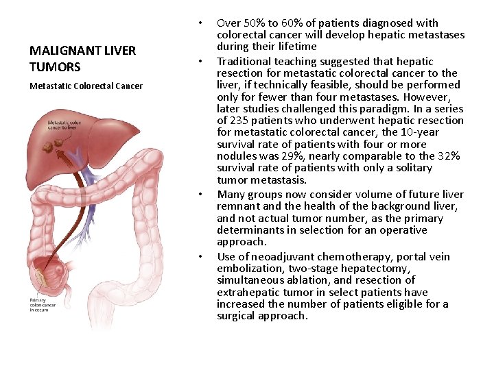  • MALIGNANT LIVER TUMORS • Metastatic Colorectal Cancer • • Over 50% to