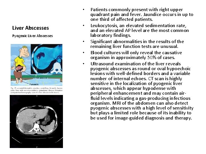  • Liver Abscesses • Pyogenic Liver Abscesses • • • Patients commonly present