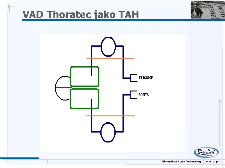 VAD Thoratec jako TAH Biomedical Data Processing G r o u p 