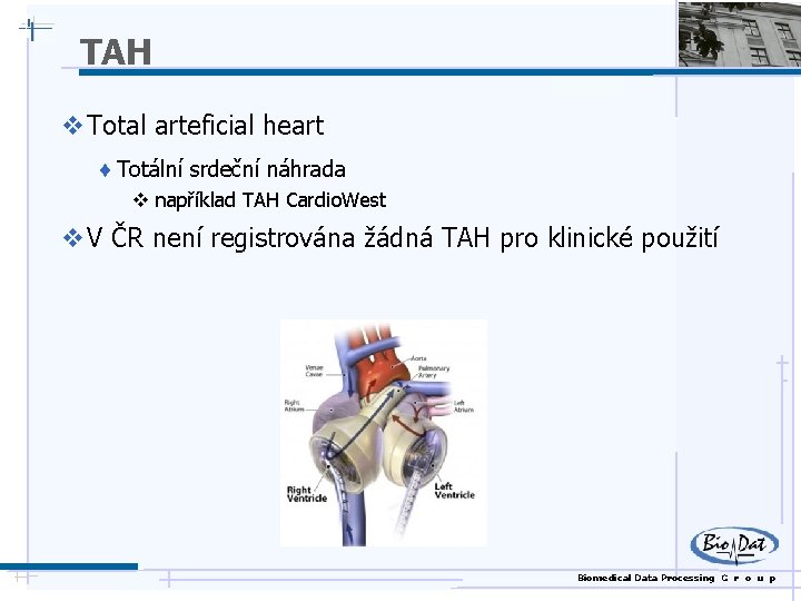 TAH v Total arteficial heart ¨ Totální srdeční náhrada v například TAH Cardio. West