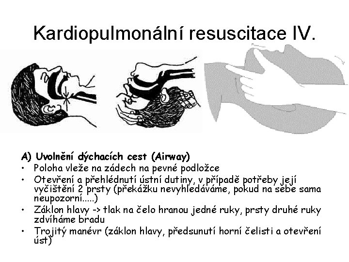 Kardiopulmonální resuscitace IV. A) Uvolnění dýchacích cest (Airway) • Poloha vleže na zádech na