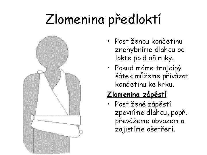 Zlomenina předloktí • Postiženou končetinu znehybníme dlahou od lokte po dlaň ruky. • Pokud