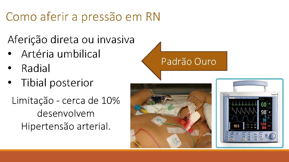 Como aferir a pressão em RN Aferição direta ou invasiva • Artéria umbilical •