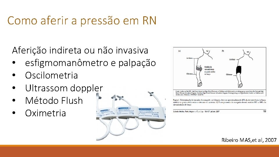 Como aferir a pressão em RN Aferição indireta ou não invasiva • esfigmomanômetro e