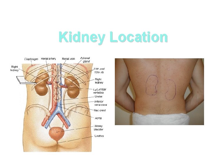 Kidney Location 