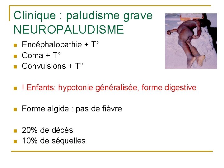Clinique : paludisme grave NEUROPALUDISME n Encéphalopathie + T° Coma + T° Convulsions +