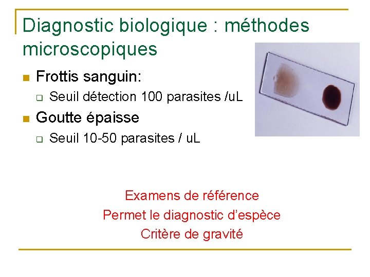 Diagnostic biologique : méthodes microscopiques n Frottis sanguin: q n Seuil détection 100 parasites