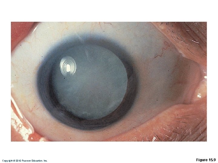 Copyright © 2010 Pearson Education, Inc. Figure 15. 9 