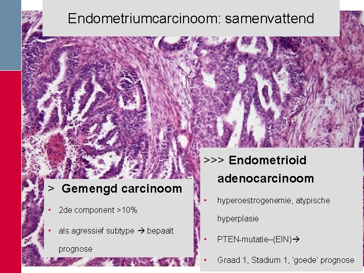 Endometriumcarcinoom: samenvattend > Gemengd carcinoom • 2 de component >10% • als agressief subtype Endometriumcarcinoom: samenvattend > Gemengd carcinoom • 2 de component >10% • als agressief subtype